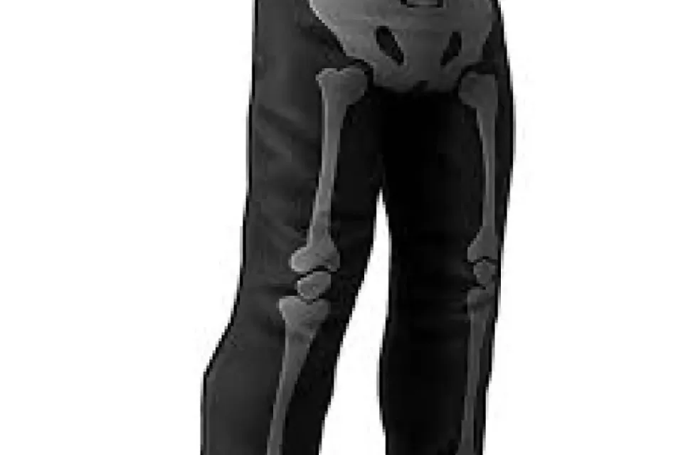 Skeleton pants ⚡ Rust